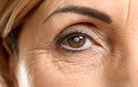 What causes a cataract?